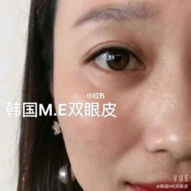 韩国m.e双眼皮是永久的吗？为什么韩国女孩都是单眼皮？ 