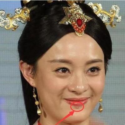 上嘴唇长痣的女星？孙俪嘴唇下为什么有痣？ 