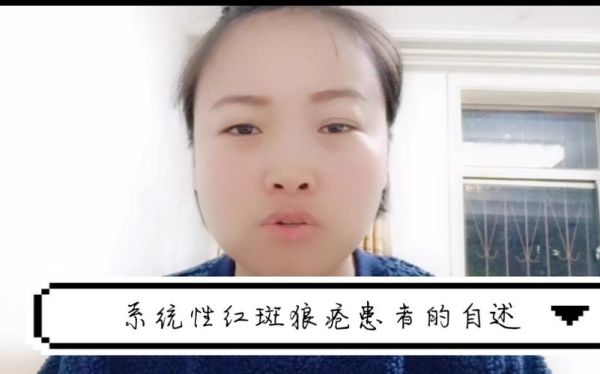 《第一次亲密接触》的女主角得了什么病？女朋友得了系统性红斑狼疮我该怎么办，我很爱她，我们都快结婚了，见面礼什么都弄好了，因为这？ 