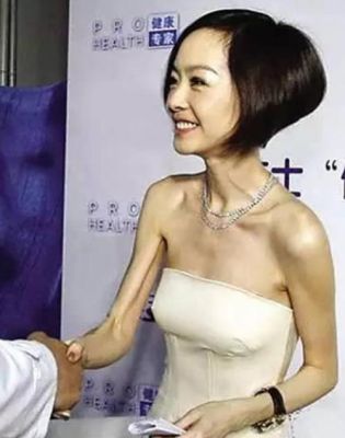 亚洲最瘦的人？最瘦的十大女演员 